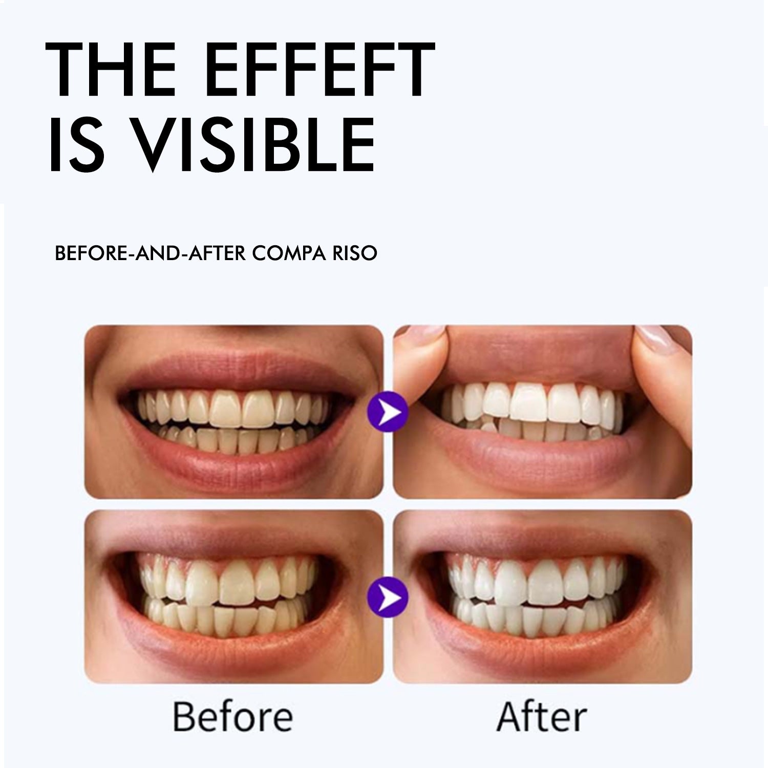 Purple Whitening Strips